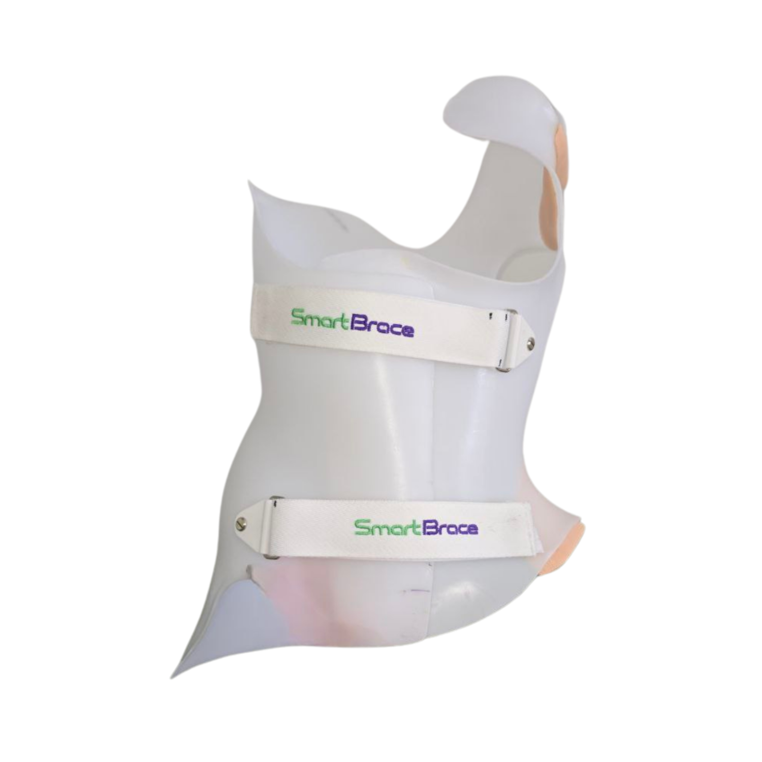 Tratamento Escoliose